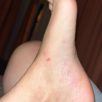 Kullanılmış Ürün Gerekçesiyle İade Alınmayan Kusurlu Terlik