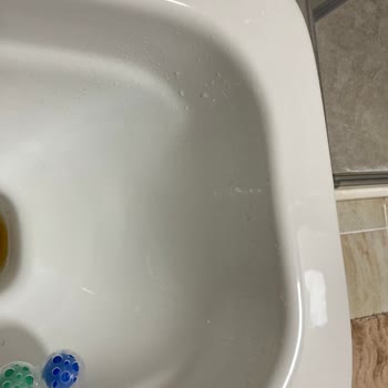 Klozet Kullanımında Sürekli Sıçrama Sorunu Ve Çözüm Beklentisi