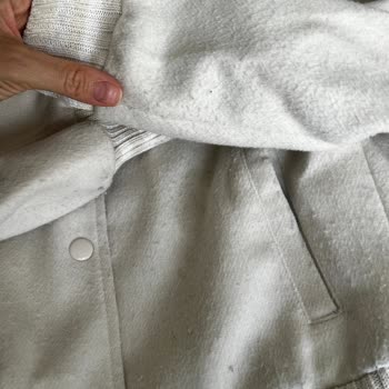 Yüksek Fiyatlı Ceket Kısa Sürede Deforme Oldu, Garanti Reddedildi