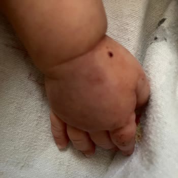 Bebeğime Kan Alımı Sırasında Yaşanan Bilinçsiz Ve Acı Verici Müdahale