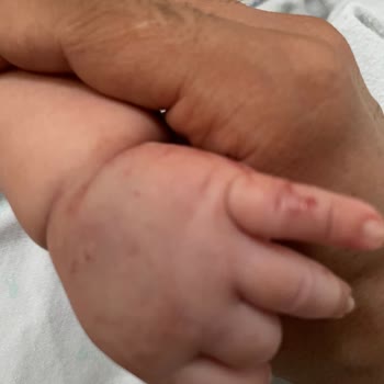 Bebeğime Kan Alımı Sırasında Yaşanan Bilinçsiz Ve Acı Verici Müdahale