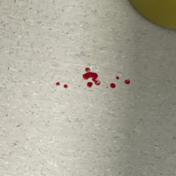 Bebeğime Kan Alımı Sırasında Yaşanan Bilinçsiz Ve Acı Verici Müdahale