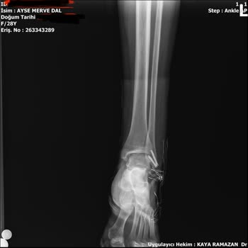 Sağlık Nedeniyle Katılamadığım Uçuşun Bilet Ücretinin İade Edilmemesi