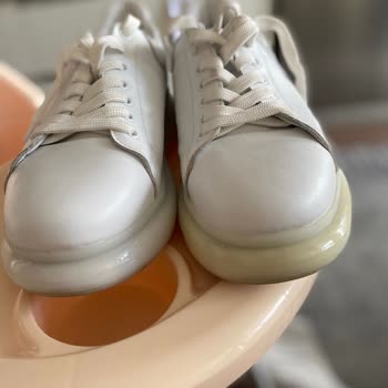 Ayakkabıda Tekrarlayan Sararma Ve Olumsuz İnceleme Sonucu Mağduriyeti