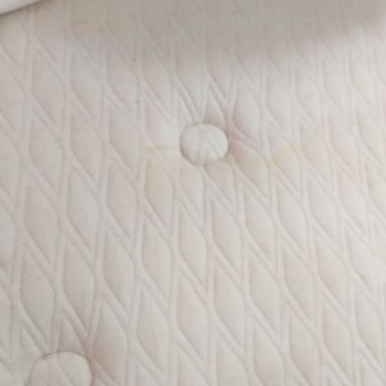 İki Yılda Sararan Yatak, İlgisiz Servis Ve Çözüm Yok