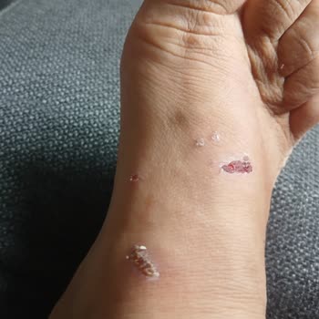 Aldığım Terlik Ayağımı Yaraladı, Değişim Ve İade Talebim Reddedildi