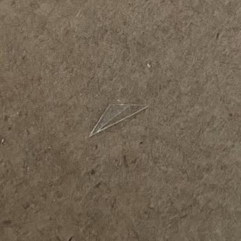 Pizzadan Çıkan Cam Parçası Çocuğumuzu Tehlikeye Attı, Çözüm Bekliyoruz