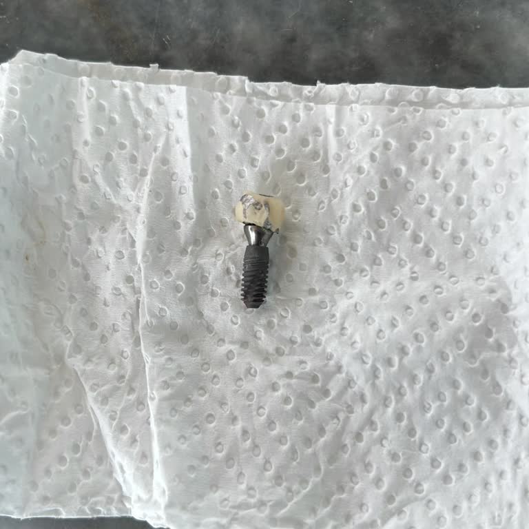 Eflatun Dental İmplantımda 1 Hafta Önce Sıkıntı Yaşamaya Başladım