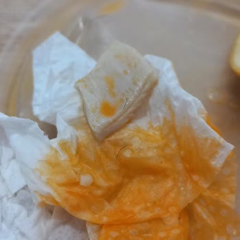 Yanık Lahmacun, Çorbada Kıl Ve Yetersiz Çözüm: Trendyol GO'da Hayal Kırıklığı