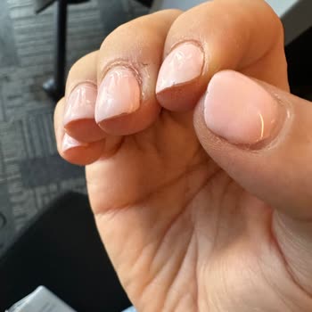 Yapılan Tırnaklar Kısa Sürede Soyuldu Ve Telafi Edilmedi