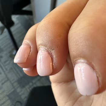 Yapılan Tırnaklar Kısa Sürede Soyuldu Ve Telafi Edilmedi