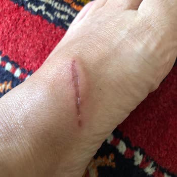 8000 TL’lik Terlik İlk Kullanımda Yaraladı, Çözüm Sunulmadı