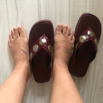 8000 TL’lik Terlik İlk Kullanımda Yaraladı, Çözüm Sunulmadı