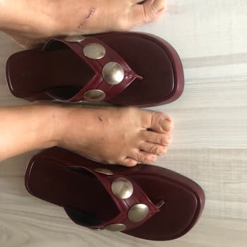 8000 TL’lik Terlik İlk Kullanımda Yaraladı, Çözüm Sunulmadı