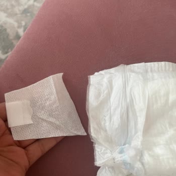 Molfix 4 Numara Bebek Bezlerinde Kopan Cırtlar Ve Aşırı Sızdırma Sorunu