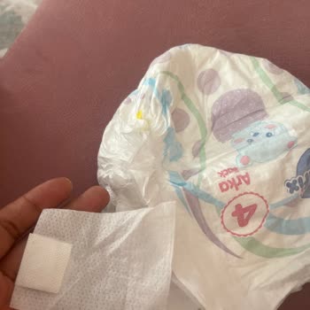 Molfix 4 Numara Bebek Bezlerinde Kopan Cırtlar Ve Aşırı Sızdırma Sorunu