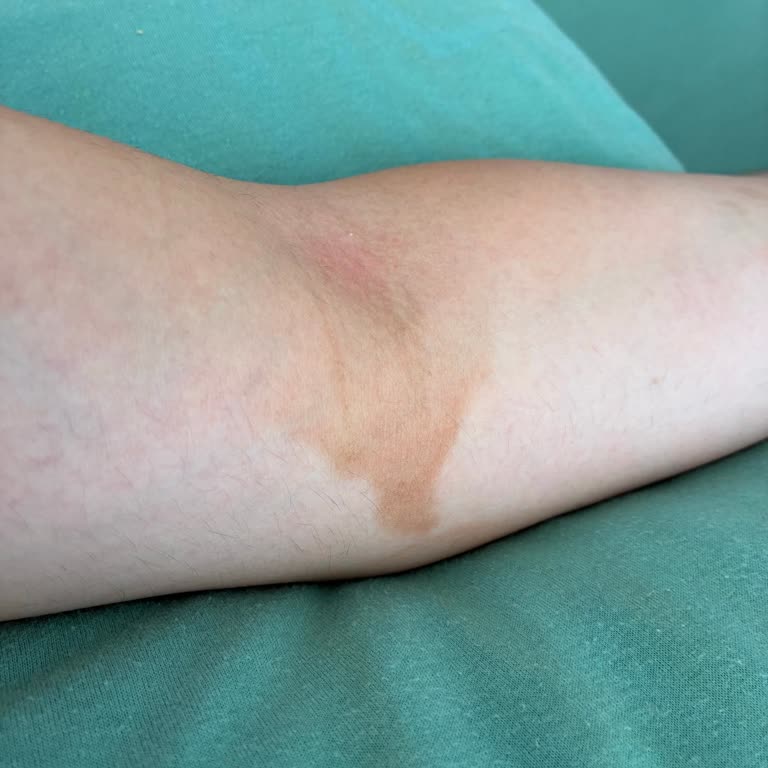 Garnier Bronzlaştırıcı Cildimde Leke Ve Düzensiz Bronzluk Oluşturdu