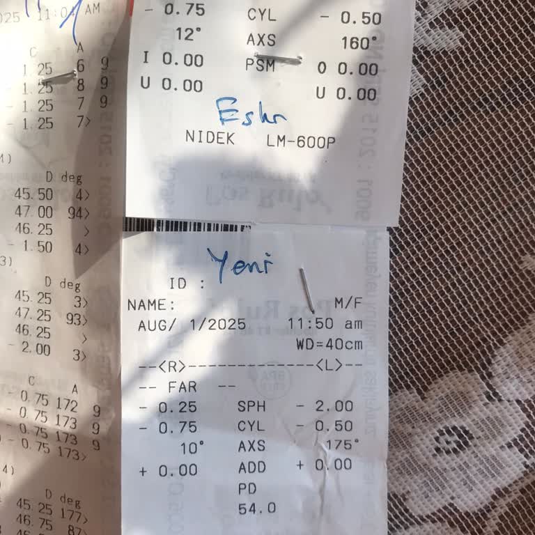 Arızalı Cihaz Nedeniyle Yanlış Gözlük Camı Ve Mağduriyet