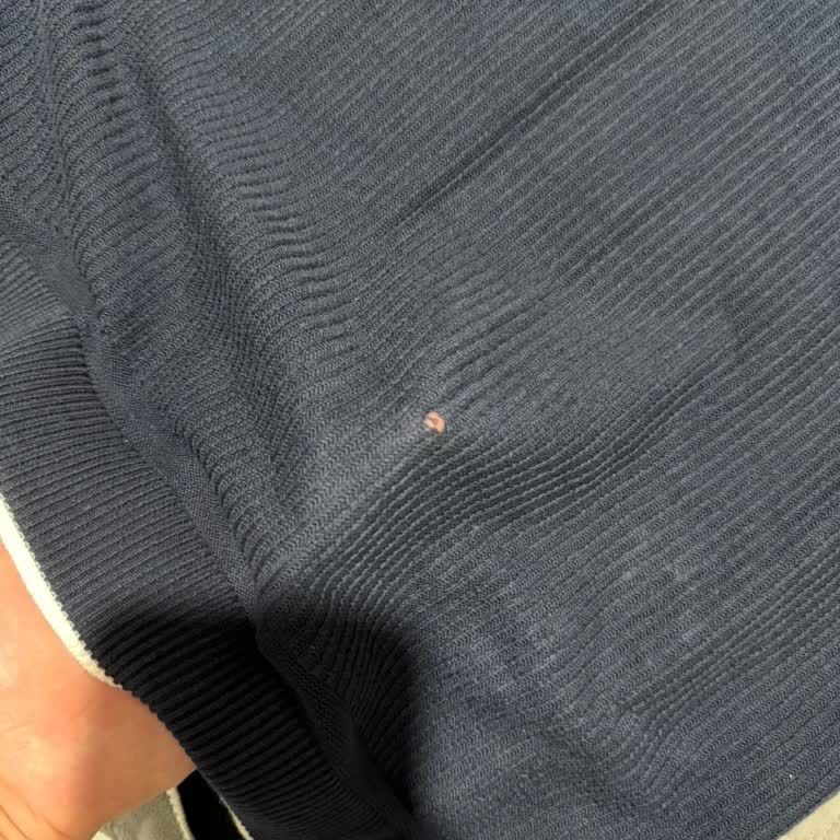 Beymen’den Alınan Ürünlerde Ciddi Kalite Sorunu Ve Yetersiz Müşteri Hizmeti