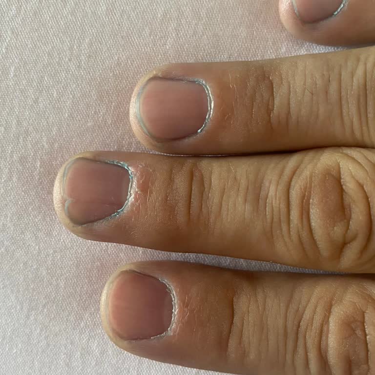 Oto Şampuanı Araca Ve Zemine Zarar Verdi, Müşteri Hizmetleri Çözüm Sunmadı