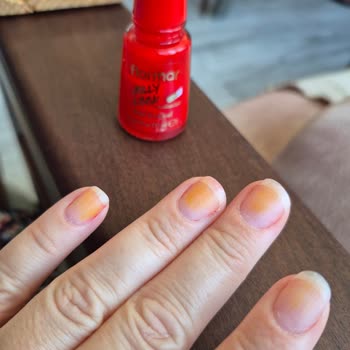 Flormar Jelly Look Oje Sonrası Tırnaklarda Turunculaşma Ve Soyulma Sorunu