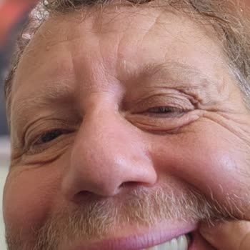 Hatalı Diş Kaplaması Sonrası Mağduriyet Ve Çözüm Eksikliği