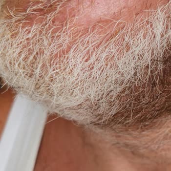 Hatalı Diş Kaplaması Sonrası Mağduriyet Ve Çözüm Eksikliği