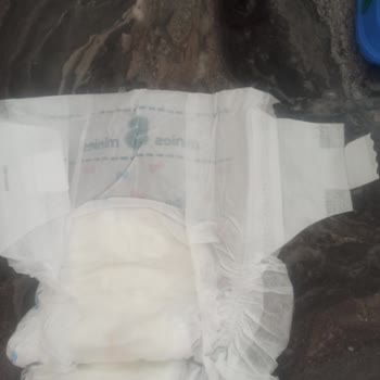 Minies Bebek Bezlerinde Yapışkan Sorunu Hayal Kırıklığı Yarattı