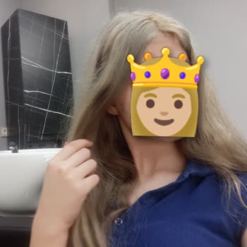 Saç Boyası Renk Sonucu Hayal Kırıklığı Ve Yoğun Yıpranma