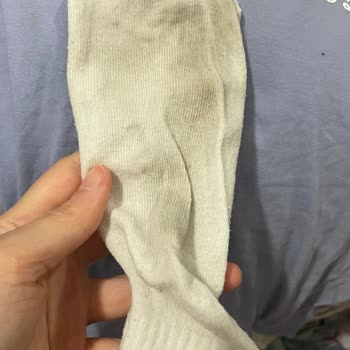 Yeni Alınan Çamaşır Makinesinde Temizlik Ve Koku Sorunu Yaşıyorum