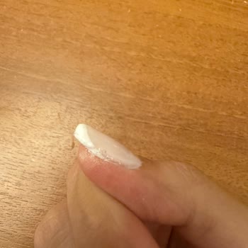 Hilal Beauty Center Müşteri Memnuniyetsizliği