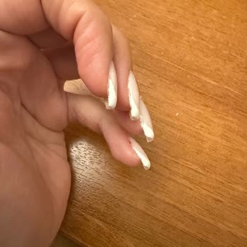 Hilal Beauty Center Müşteri Memnuniyetsizliği