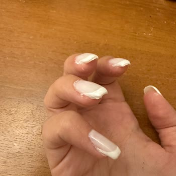 Hilal Beauty Center Müşteri Memnuniyetsizliği