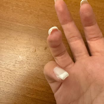 Hilal Beauty Center Müşteri Memnuniyetsizliği