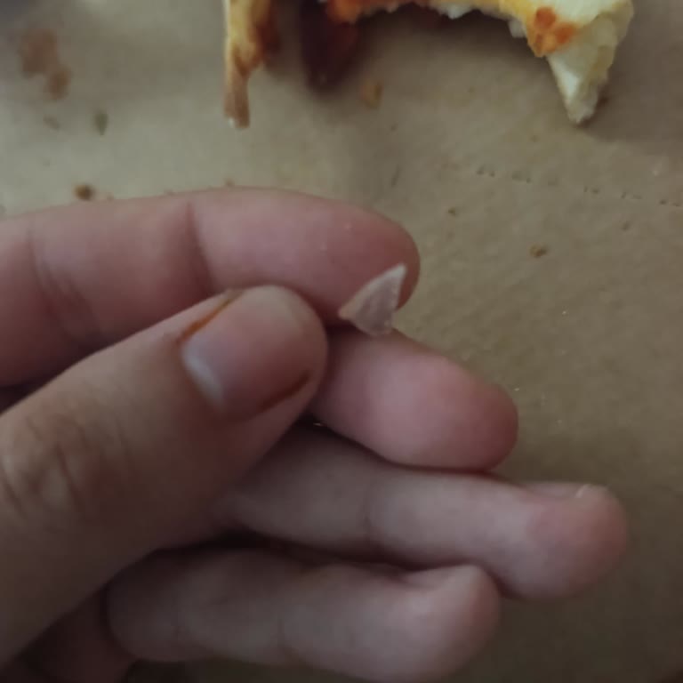 Pizzadan Cam Parçası Çıktı, Hayatımız Tehlikedeydi