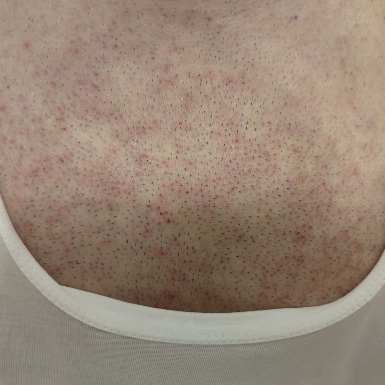 Epify Ürün İçeriği Ve Müşteri Hizmetleri Hayal Kırıklığı Yarattı