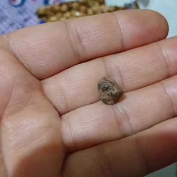 Simbat Leblebiden Taş Çıktı Dişim Kırıldı