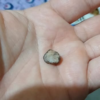 Simbat Leblebiden Taş Çıktı Dişim Kırıldı