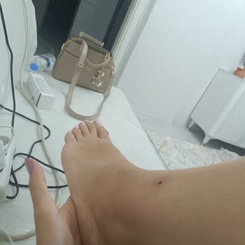 Yanlış Uygulama Sonucu Sağlık Sorunları Ve İade Sorunu Yaşadım