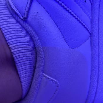İki Kere Giyilen Adidas Ayakkabıda Deri Soyulması Şoku