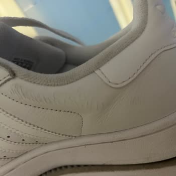 İki Kere Giyilen Adidas Ayakkabıda Deri Soyulması Şoku