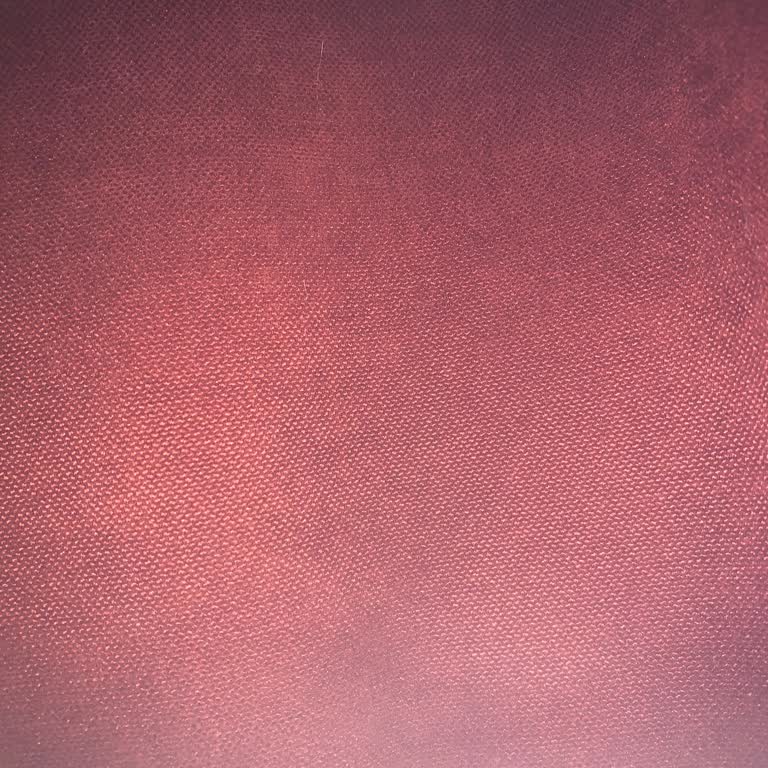 TÜRKSAT Kablo Net'te Sürekli İnternet Yavaşlığı Ve Destek Talebi