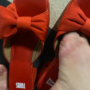 Aldığım Terlik Ayağımı Yaraladı, Mağazadan Destek Alamıyorum