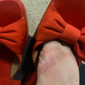 Aldığım Terlik Ayağımı Yaraladı, Mağazadan Destek Alamıyorum