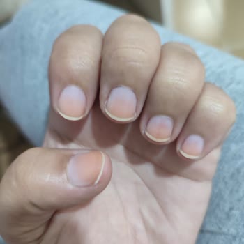 Flormar Oje Tırnaklarımda Kalıcı Turunculaşmaya Sebep Oldu