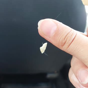 Dondurmada Kıl Çıkması Nedeniyle Hijyen Endişesi Ve Hayal Kırıklığı