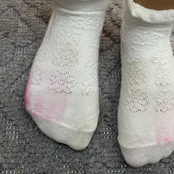 Işıklı Sandalet Çorap Ve Ayakta Kalıcı Renk İzi Bırakıyor Çözüm Sunulmuyor