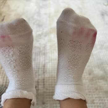 Işıklı Sandalet Çorap Ve Ayakta Kalıcı Renk İzi Bırakıyor Çözüm Sunulmuyor