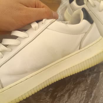 Calvin Klein Ayakkabıda Sararma Ve Garanti Süresi Mağduriyeti