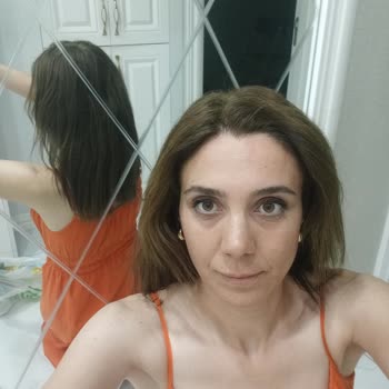 Saç Boyası Sonrası Şiddetli Yanma Ve Aşırı Saç Dökülmesi Yaşadım